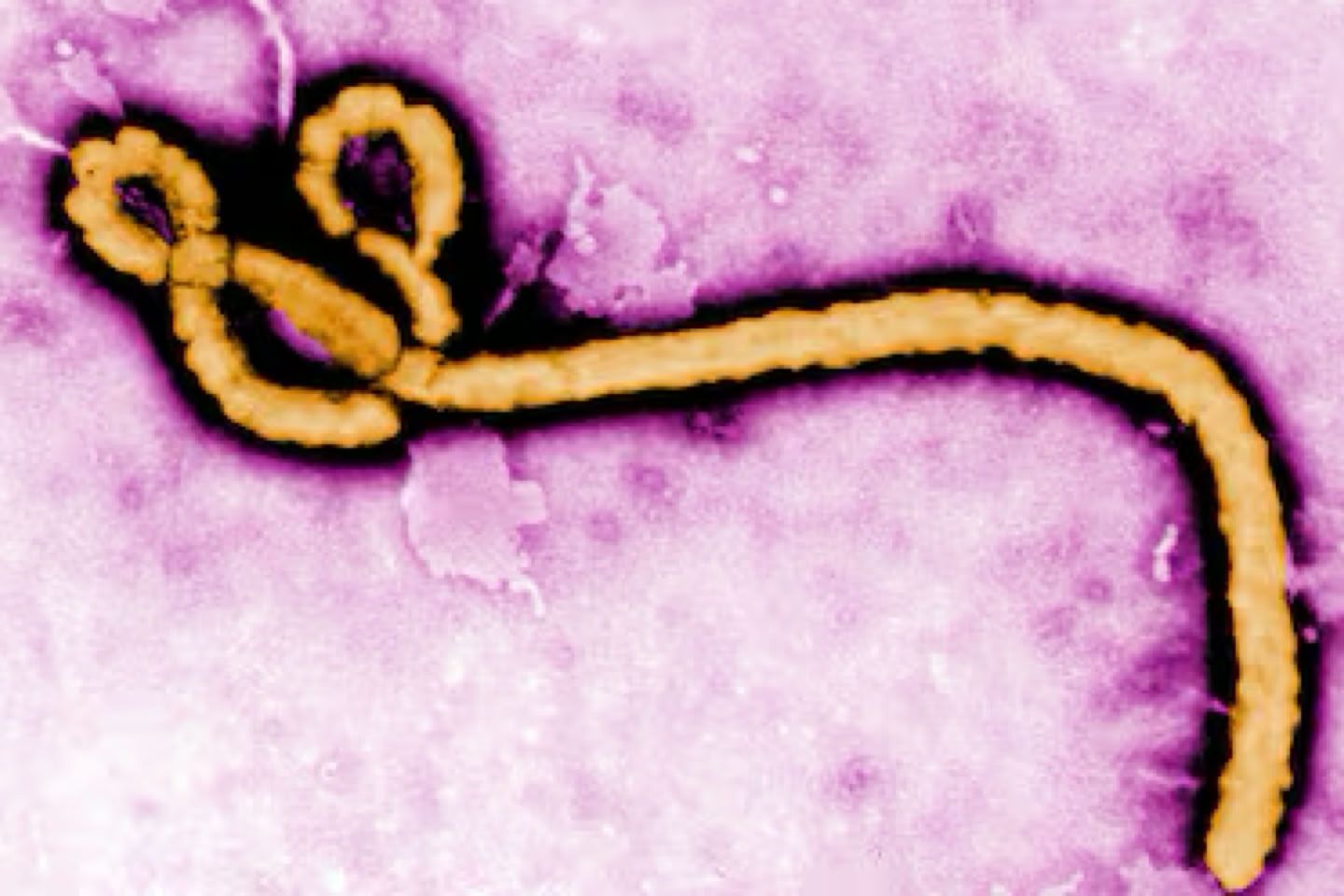 A microscopic view of a filamentous ebola virus against a purple background.